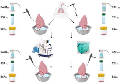 The impact of the EVLP on the lung microbiome and its inflammatory reaction